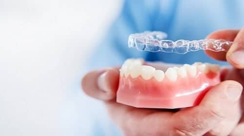 Important to Have Your Smile